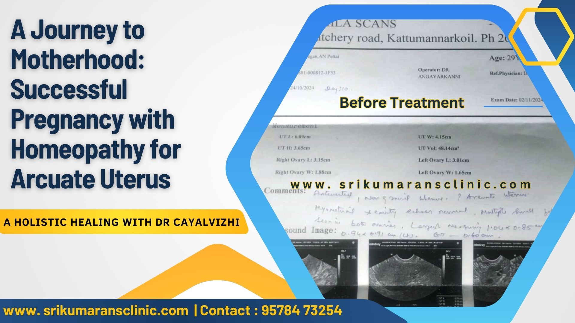 Protected Case Image