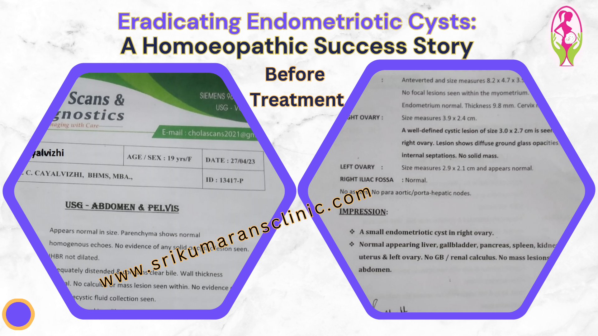 Protected Case Image